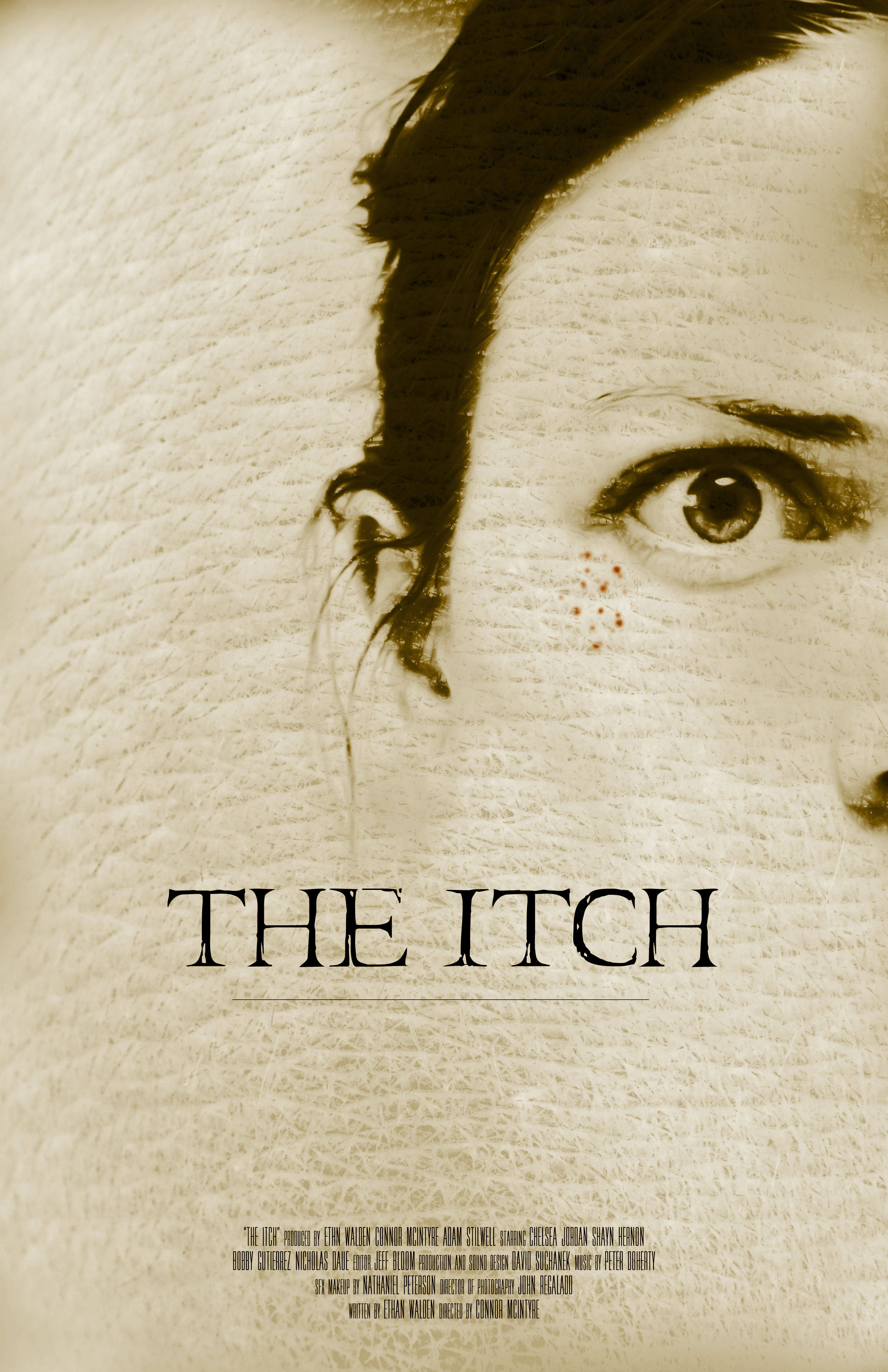 The Itch